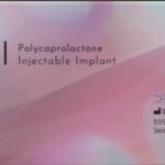 Gouri | PCL Injizierbares Implantat