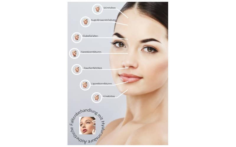 Poster Faltenunterspritzung